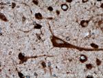 TMEM85 Antibody in Immunohistochemistry (Paraffin) (IHC (P))