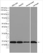 TMEM85 Antibody in Western Blot (WB)