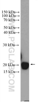TMEM85 Antibody in Western Blot (WB)