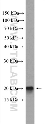 TMEM85 Antibody in Western Blot (WB)