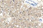 Perilipin 1 Antibody in Immunohistochemistry (Paraffin) (IHC (P))