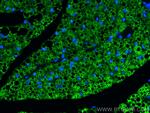 Perilipin 1 Antibody in Immunohistochemistry (PFA fixed) (IHC (PFA))
