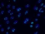 RRP1B Antibody in Immunocytochemistry (ICC/IF)