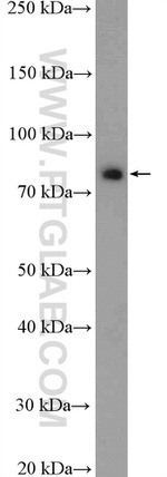 RRP1B Antibody in Western Blot (WB)