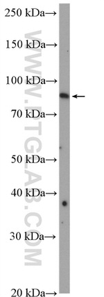 RRP1B Antibody in Western Blot (WB)