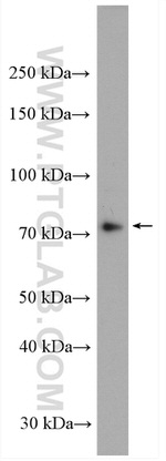 ABI3BP Antibody in Western Blot (WB)