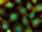 Flightless I Antibody in Immunocytochemistry (ICC/IF)