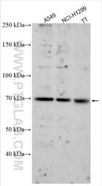 MFSD6L Antibody in Western Blot (WB)