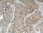 ECHDC1 Antibody in Immunohistochemistry (Paraffin) (IHC (P))