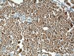 ECHDC1 Antibody in Immunohistochemistry (Paraffin) (IHC (P))