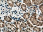 ECHDC1 Antibody in Immunohistochemistry (Paraffin) (IHC (P))