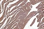 Nexilin Antibody in Immunohistochemistry (Paraffin) (IHC (P))