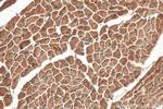 Nexilin Antibody in Immunohistochemistry (Paraffin) (IHC (P))