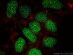 Histone H2B Antibody in Immunocytochemistry (ICC/IF)