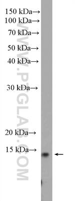 Histone H2B Antibody in Western Blot (WB)