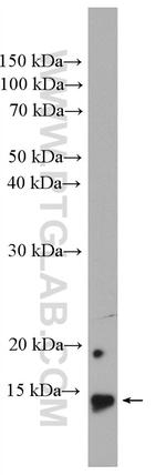 Histone H2B Antibody in Western Blot (WB)