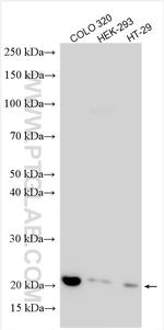 Histone H2B Antibody in Western Blot (WB)