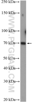 TGM7 Antibody in Western Blot (WB)