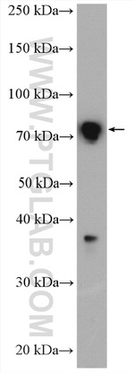 TGM7 Antibody in Western Blot (WB)