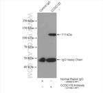 Syndetin/CCDC132 Antibody in Immunoprecipitation (IP)