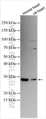 RRAD Antibody in Western Blot (WB)