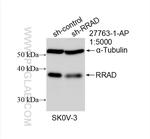 RRAD Antibody in Western Blot (WB)