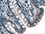 GET4 Antibody in Immunohistochemistry (Paraffin) (IHC (P))