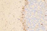 PNPLA7 Antibody in Immunohistochemistry (Paraffin) (IHC (P))