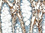 Periostin Antibody in Immunohistochemistry (Paraffin) (IHC (P))