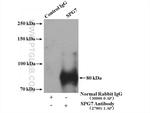 SPG7 Antibody in Immunoprecipitation (IP)