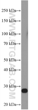 RanBP1 Antibody in Western Blot (WB)