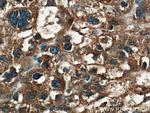 PPP4R1 Antibody in Immunohistochemistry (Paraffin) (IHC (P))