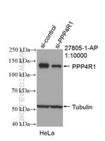 PPP4R1 Antibody in Western Blot (WB)