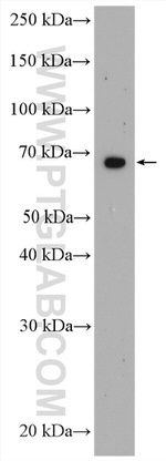 ZNF570 Antibody in Western Blot (WB)
