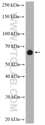 ZNF570 Antibody in Western Blot (WB)