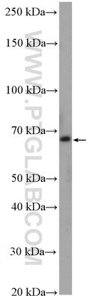ZNF570 Antibody in Western Blot (WB)