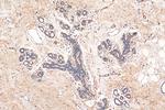 MRP1 Antibody in Immunohistochemistry (Paraffin) (IHC (P))