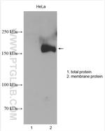 MRP1 Antibody in Western Blot (WB)
