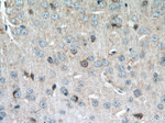 MTSS1L Antibody in Immunohistochemistry (Paraffin) (IHC (P))
