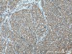 FMNL1 Antibody in Immunohistochemistry (Paraffin) (IHC (P))