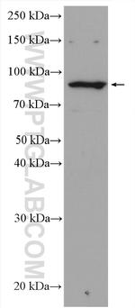 RASA2/3 Antibody in Western Blot (WB)