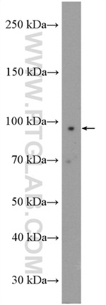 RASA2/3 Antibody in Western Blot (WB)