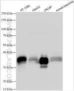 GDF15 Antibody in Western Blot (WB)