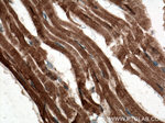 C22orf25 Antibody in Immunohistochemistry (Paraffin) (IHC (P))