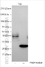 OSBPL5 Antibody in Western Blot (WB)