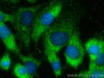 Endothelin 3 Antibody in Immunocytochemistry (ICC/IF)