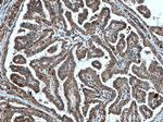 Endothelin 3 Antibody in Immunohistochemistry (Paraffin) (IHC (P))