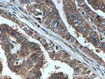 Endothelin 3 Antibody in Immunohistochemistry (Paraffin) (IHC (P))