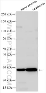 Endothelin 3 Antibody in Western Blot (WB)