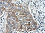 gamma catenin Antibody in Immunohistochemistry (Paraffin) (IHC (P))
